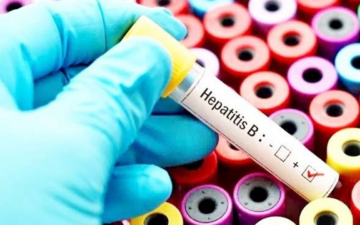 Uzmandan Hepatit