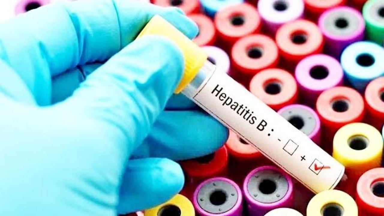 Uzmandan Hepatit
